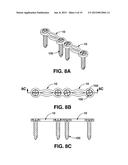 COMPRESSION BRACE diagram and image