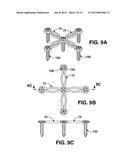 COMPRESSION BRACE diagram and image