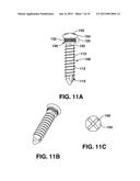 COMPRESSION BRACE diagram and image