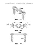 COMPRESSION BRACE diagram and image