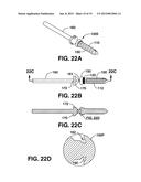 COMPRESSION BRACE diagram and image