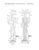 SUTURE ANCHOR AND RELATED METHOD diagram and image