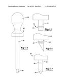 SUTURE ANCHOR AND RELATED METHOD diagram and image