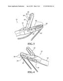 SUTURE PASSER diagram and image