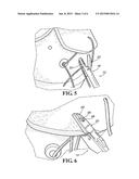 SUTURE PASSER diagram and image