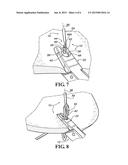 SUTURE PASSER diagram and image