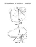 SUTURE PASSER diagram and image