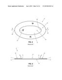 SEGMENTED SKIRTED SURGICAL MESH diagram and image