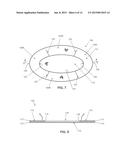 SEGMENTED SKIRTED SURGICAL MESH diagram and image