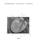 SEGMENTED SKIRTED SURGICAL MESH diagram and image