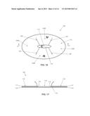 SEGMENTED SKIRTED SURGICAL MESH diagram and image