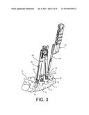 PEDICLE SCREW EXTENSION FOR USE IN PERCUTANEOUS SPINAL FIXATION diagram and image