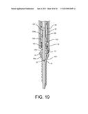 PEDICLE SCREW EXTENSION FOR USE IN PERCUTANEOUS SPINAL FIXATION diagram and image