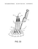 PEDICLE SCREW EXTENSION FOR USE IN PERCUTANEOUS SPINAL FIXATION diagram and image