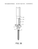 PEDICLE SCREW EXTENSION FOR USE IN PERCUTANEOUS SPINAL FIXATION diagram and image