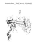 PEDICLE SCREW EXTENSION FOR USE IN PERCUTANEOUS SPINAL FIXATION diagram and image