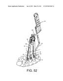 PEDICLE SCREW EXTENSION FOR USE IN PERCUTANEOUS SPINAL FIXATION diagram and image