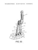 PEDICLE SCREW EXTENSION FOR USE IN PERCUTANEOUS SPINAL FIXATION diagram and image