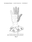 Neurostimulator Configured to Sense Evoked Potentials in Peripheral Nerves diagram and image