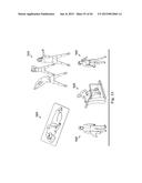 Neurostimulator Configured to Sense Evoked Potentials in Peripheral Nerves diagram and image