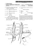 TRANSVASCULAR NERVE STIMULATION APPARATUS AND METHODS diagram and image