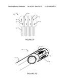 TRANSVASCULAR NERVE STIMULATION APPARATUS AND METHODS diagram and image