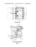 TRANSVASCULAR NERVE STIMULATION APPARATUS AND METHODS diagram and image