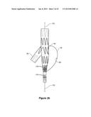 ENDOVASCULAR GRAFT HAVING A CANNULATION POCKET diagram and image