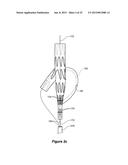 ENDOVASCULAR GRAFT HAVING A CANNULATION POCKET diagram and image