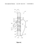 ENDOVASCULAR GRAFT HAVING A CANNULATION POCKET diagram and image