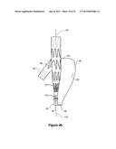 ENDOVASCULAR GRAFT HAVING A CANNULATION POCKET diagram and image