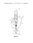 ENDOVASCULAR GRAFT HAVING A CANNULATION POCKET diagram and image