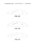 BREAST PROSTHESES, METHODS OF MANUFACTURING BREAST PROSTHESES, AND METHODS     OF TREATMENT USING BREAST PROSTHESES diagram and image