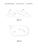 BREAST PROSTHESES, METHODS OF MANUFACTURING BREAST PROSTHESES, AND METHODS     OF TREATMENT USING BREAST PROSTHESES diagram and image