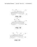 BREAST PROSTHESES, METHODS OF MANUFACTURING BREAST PROSTHESES, AND METHODS     OF TREATMENT USING BREAST PROSTHESES diagram and image