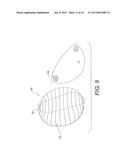 BREAST PROSTHESES, METHODS OF MANUFACTURING BREAST PROSTHESES, AND METHODS     OF TREATMENT USING BREAST PROSTHESES diagram and image