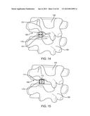 METHODS AND APPARATUS FOR IMPLANTING AN INTERBODY DEVICE diagram and image