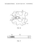 METHODS AND APPARATUS FOR IMPLANTING AN INTERBODY DEVICE diagram and image