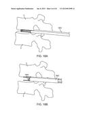 METHODS AND APPARATUS FOR IMPLANTING AN INTERBODY DEVICE diagram and image