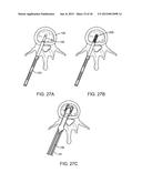 METHODS AND APPARATUS FOR IMPLANTING AN INTERBODY DEVICE diagram and image