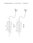 FLY-FISHING FLOAT OR STRIKE INDICATOR AND ATTACHMENT METHODS diagram and image