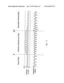 VENTILATORY ASSISTANCE FOR TREATMENT OF CARDIAC FAILURE AND CHEYNE-STOKES     BREATHING diagram and image