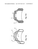 HOLLOW STRUCTURE FOR BREATHING MASK diagram and image