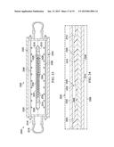 Metallic Bladders diagram and image