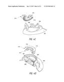 CLOSURE DEVICES INCLUDING INCREMENTAL RELEASE MECHANISMS AND METHODS     THEREFOR diagram and image