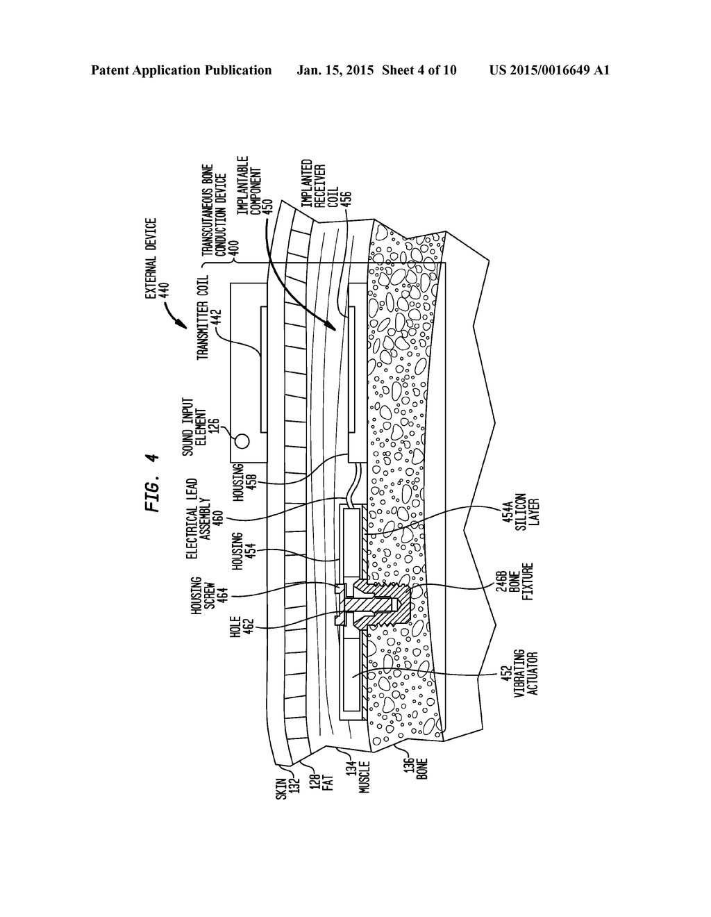 VIBRATION ISOLATION IN A BONE CONDUCTION DEVICE - diagram, schematic, and image 05