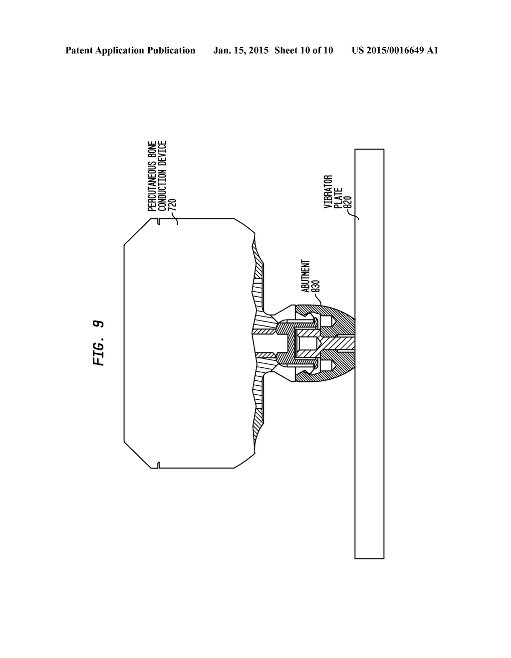 VIBRATION ISOLATION IN A BONE CONDUCTION DEVICE - diagram, schematic, and image 11