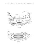 AGILITY AND STRENGTH IMPROVEMENT APPARATUS diagram and image