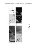 METHODS OF DIAGNOSING TAU-ASSOCIATED NEURODEGENERATIVE DISEASES diagram and image