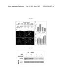 PHOSPHORYLATION ON THE THR-248 AND/OR THR-250 RESIDUES OF TRANSCRIPTION     FACTOR E2F4 AS A THERAPEUTIC TARGET IN PATHOLOGICAL PROCESSES ASSOCIATED     WITH SOMATIC POLYPLOIDY diagram and image